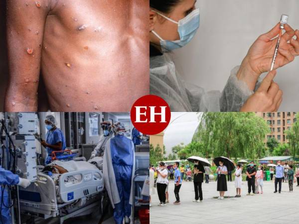 ¿Ya es una pandemia? ¿Nos volverán a confinar en nuestras casas? ¿Es altamente mortal? ¿Tiene cura? Esas son algunas de las preguntas que han surgido este sábado, luego de que la Organización Mundial de la Salud (OMS) declarara alerta internacional por la viruela del mono, la extraña enfermedad que ha comenzado a reportar casos en varios países. A continuación te explicamos qué significa la determinación del organismo internacional.