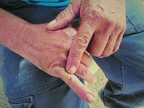 El portavoz del Hospital Escuela, Miguel Osorio, informó que las edades de las víctimas están entre dos y 85 años.