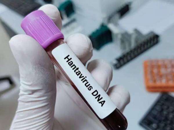 Ante el avance de casos de hantavirus en América, expertos advierten que Honduras debe intensificar la vigilancia epidemiológica para prevenir su ingreso.