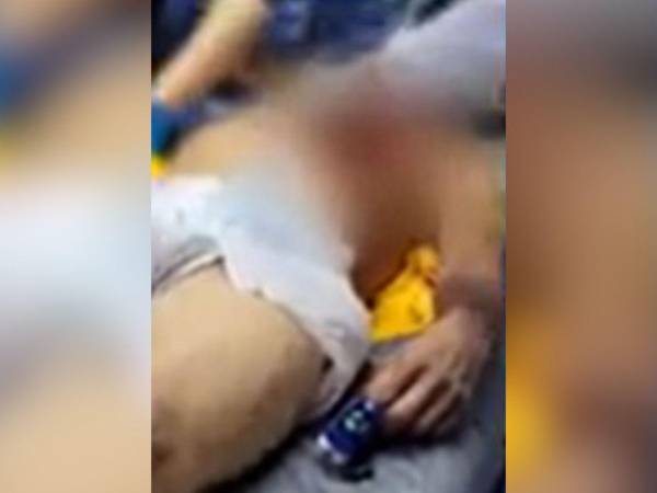 La persona ya fue atendida en un centro asistencial.