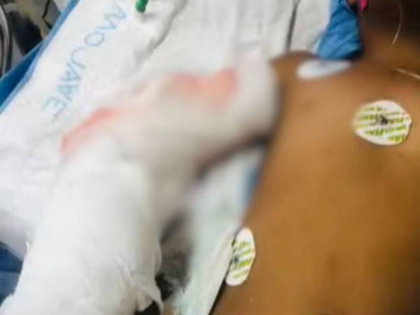 Familiares piden ayuda para poder cubrir los gastos de la cirugía del menor y de su madre.