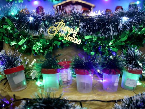 Fotografía que muestra contenedores con piezas dentales extraídas de personas, en un pesebre del área de cirugía del Instituto Nacional de Enfermedades Respiratorias y del Ambiente este martes, en Asunción (Paraguay).