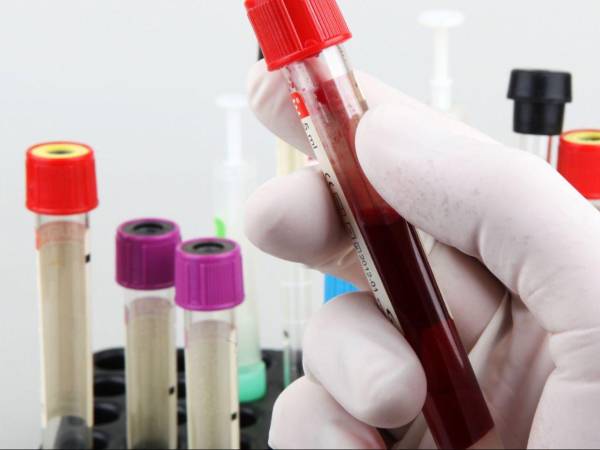 El único laboratorio autorizado para tomar y procesar muestras para detectar el virus del sarampión es el Laboratorio Nacional de Virología.