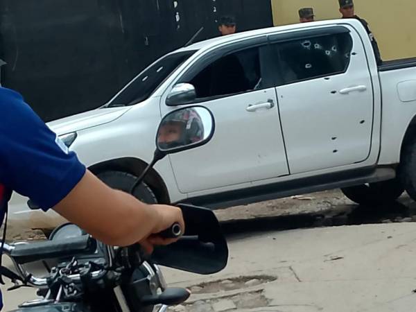 Un hombre sobrevivió con heridas en su brazo este miércoles 22 de abril tras sufrir un atentado criminal en el barrio La Hoya de Juticalpa, Olancho. El sicario huyó sin lograr su cometido y ahora es buscado por las autoridades que trabajan en su identificación.