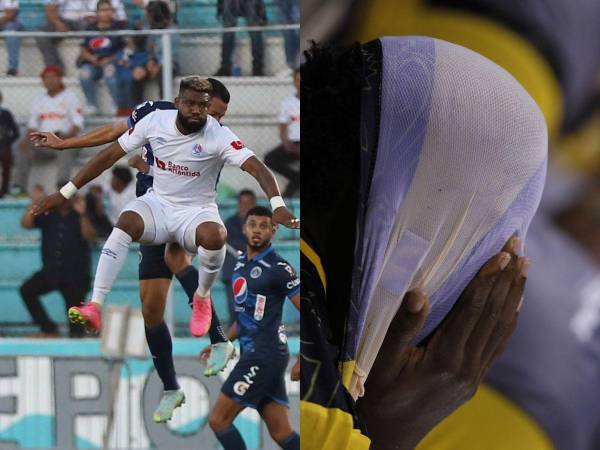 En una intensa jornada 14 del Torneo Apertura 2023, los equipos de la Liga Nacional de Honduras dieron lo mejor de sí. Estas son las imágenes que no se vieron en la TV.