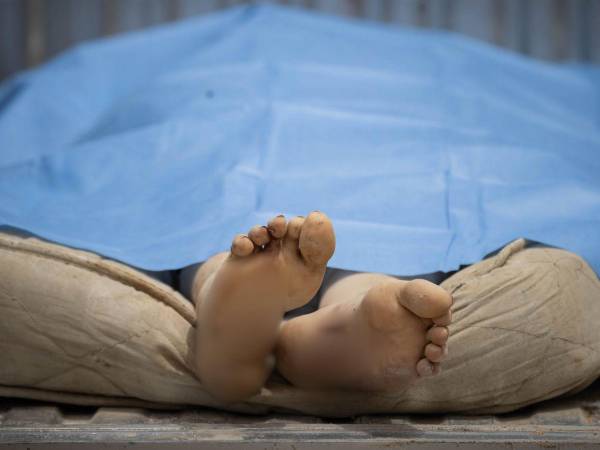 El aire que se respira este viernes en las zonas de desastre del estado costero de La Guaira en Venezuela ya comienza a oler a putrefacción, producto de los cadáveres que aún permanecen sepultados entre los escombros de los edificios colapsados.