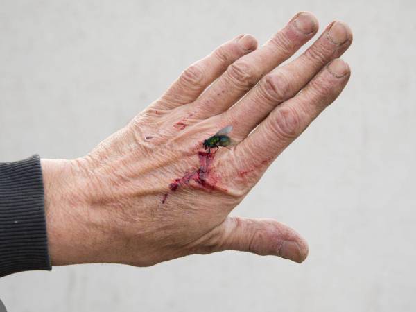 La mosca del gusano barrenador no escoge meticulosamente a sus víctimas para poner las larvas, lo hace en cualquier parte del cuerpo en el que haya una herida expuesta, no importa si es tan pequeña como la picada de una garrapata. Así invade y prolifera el gusano barrenador una herida.