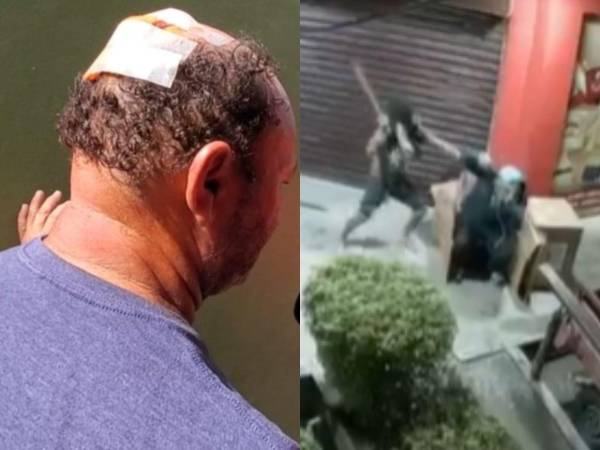El guardia de seguridad en La Ceiba, Walter González, relata el violento ataque que sufrió en las afueras de un supermercado y denuncia que, aunque identificó y declaró contra el agresor, este quedó libre.