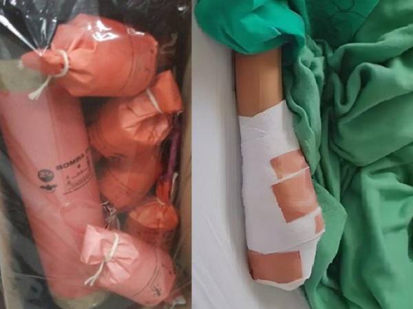 Un menor de cinco años perdió su mano producto de la manipulación de pólvora.