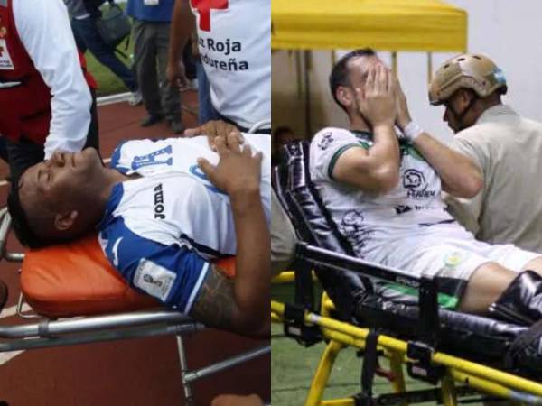 A continuación repasamos las acciones más estremecedoras que se han dado en partidos de la Liga Nacional y de la Selección de Honduras.