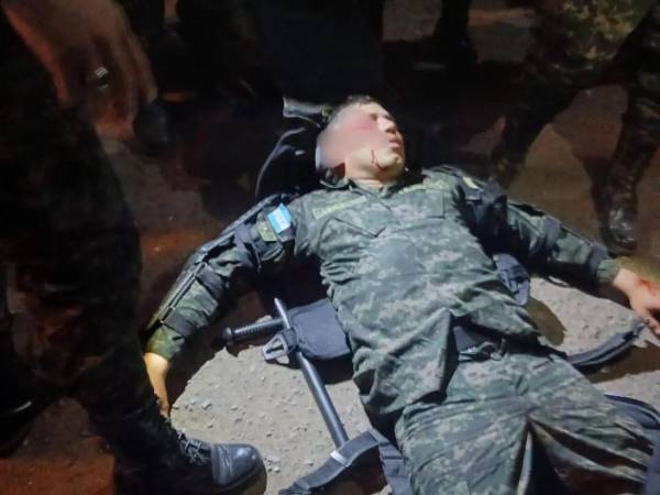 Luego de la fuerte explosión, el militar salió con varias heridas en su rostro. Autoridades dijeron que ya le dieron el alta médica.