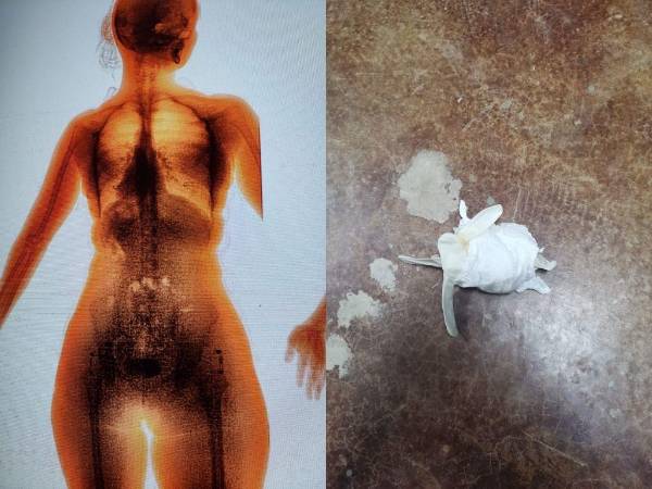 El objeto en el cuerpo de la fémina fue detectado a través del BodyScann.