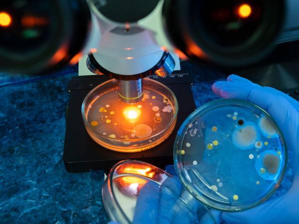 La bacteria Vibrio vulnificus se alimenta de carne humana y puede contraerse si los mariscos a consumir no están debidamente cocidos.