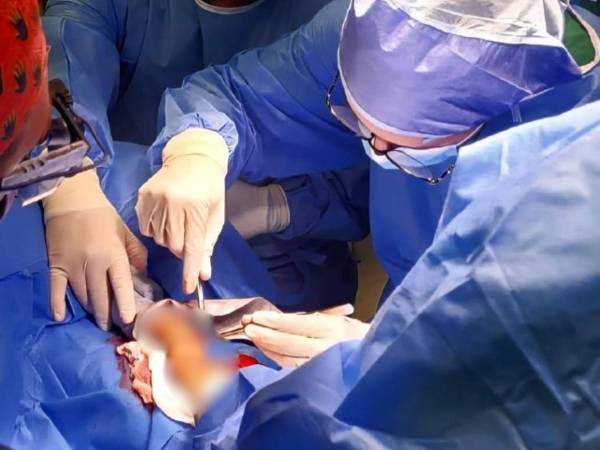 El personal médico engargado de la jornada aseguró que las cirugías buscan mejorar la movilidad, funcionalidad y calidad de vida de los pacientes involucrados en la actividad.