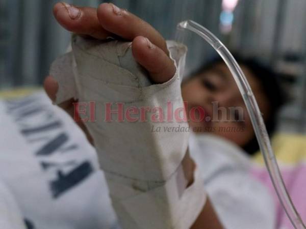 La epidemia de dengue se ensañó más este año con los menores de 15 años de edad.