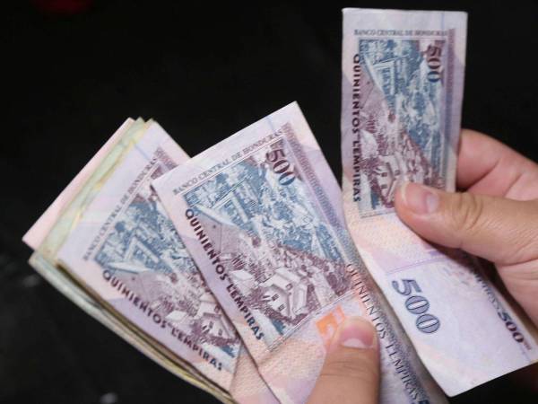 Sostiene que la mejoría de 47 puntos en el EMBI de Honduras significa que “hay menos percepción de riesgo”.