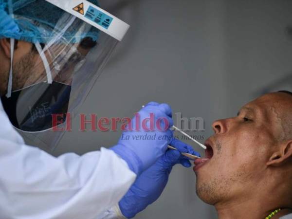 Detectar a los asintomáticos con covid-19 es clave para frenar la cadena de transmisión del virus, así que los expertos recomiendan aplicar pruebas a quienes hayan tenido nexos con los enfermos. Foto: EL HERALDO.