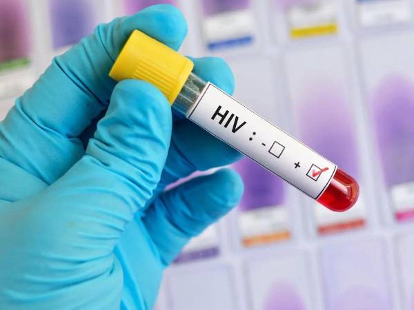 El tratamiento retroviral para el VIH, es gratuito y se encuentra de forma accesible en 66 centros de salud a nivel nacional.