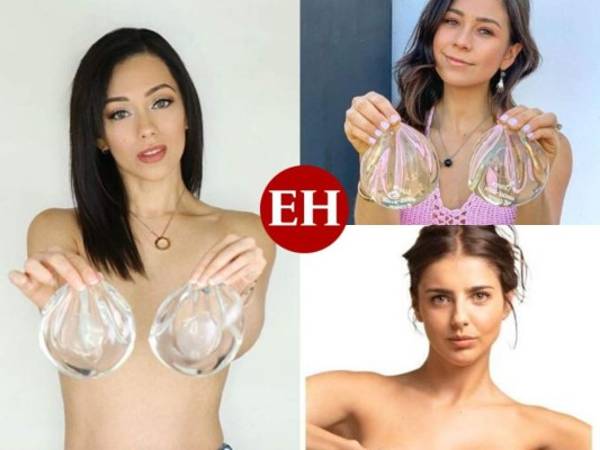 Muchas de estas famosas mujeres presentaron problemas de acné, pérdida de cabello, mareos y fatiga por los implantes mamarios. Estos síntomas son parte de la Enfermedad por Implantes Mamarios. Estas son sus historias.