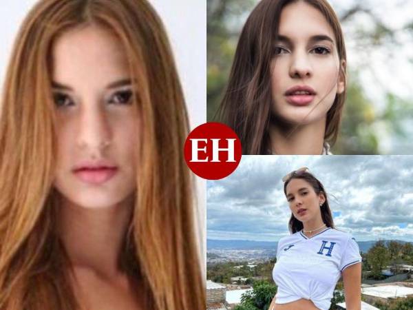 Ary ha sido muy abierta a hablar sobre sus cirugías estéticas. La modelo y empresaria se operó en México hace más de cuatro años. La venezolana asegura estar feliz con su cambio físico.