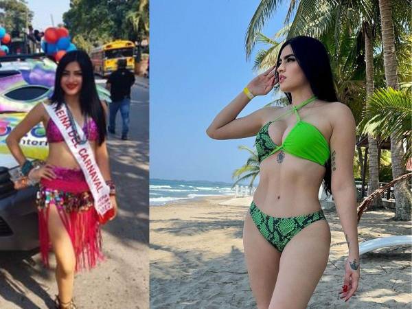 El aparente cambio físico de Roxana Somoza, continúa siendo un tema de polémica en redes sociales, sin embargo, la “influencer” hondureña le ha hecho frente a las constantes críticas en torno a la forma en la que se ve su cuerpo actualmente. A continuación te mostramos algunas imágenes que muestran cómo ha sido su transformación física antes y después de varios retoques estéticos.