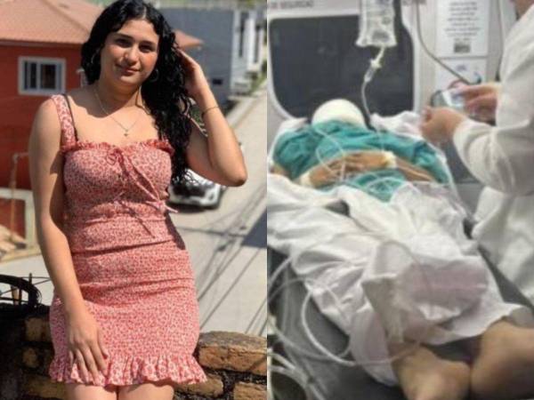 Una madre de 22 años cayó desde una rueda de Chicago el pasado 16 de agosto, por lo que fue trasladada con graves lesiones al Hospital Mario Catarino Rivas de San Pedro Sula.
