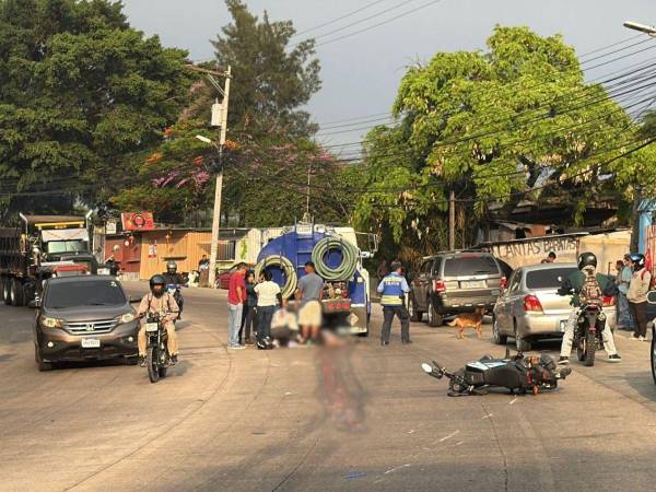 Personas cercanas al lugar se acercaron a ayudar a la víctima, quien perdió su pierna tras ser aplastada por el camión cisterna.