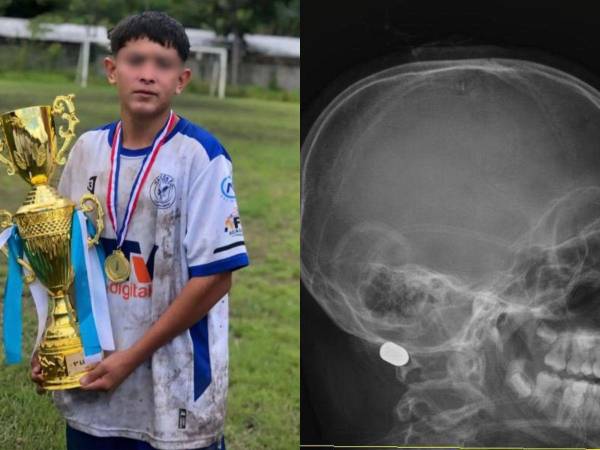 Emerson Isaac Díaz Villanueva, un menor de 14 años, habría muerto tras recibir el impacto de una bala perdida en la comunidad de Coalaca Las Flores, en el departamento de Lempira. Aquí los detalles: