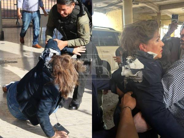 Gladys Aurora López es diputada del Partido Nacional ante el Parlamento Centroamericano (Parlacen) que fue atacada con un explosivo en las instalaciones del Congreso Nacional. Aquí las imágenes del hecho.