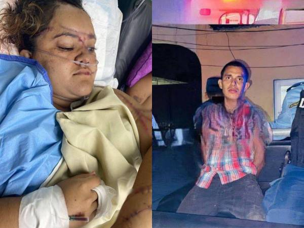 Un video se viralizó en redes sociales mostrando el horror vivido en el barrio Barandillas de San Pedro Sula, donde una mujer corre desesperadamente, mientras su esposo la persigue con un machete y comienza a agredirla.