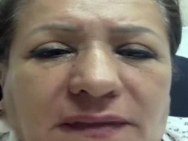 López sufrió lesiones en la espalda y la cabeza, por lo que fue trasladada de emergencia a un centro asistencial para recibir atención médica.