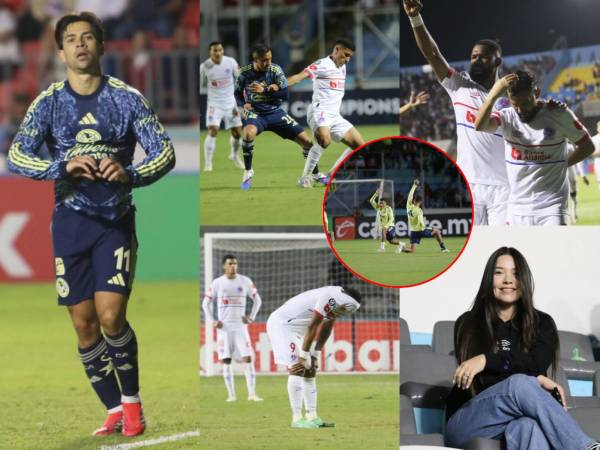 Olimpia cayó este martes por marcador de 1-2 ante el América de México en Concacaf Champions Cup. Te mostramos las mejores imágenes del juego.