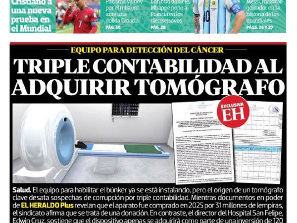 Triple contabilidad al adquirir tomógrafó en el San Felipe