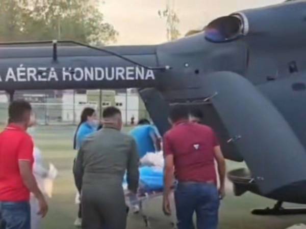 El menor fue trasladado a Tegucigalpa vía aérea, sin embargo, debido a las fuertes quemaduras en su cuerpo, falleció.