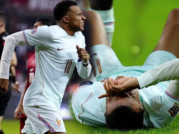 Kylian Mbappe salió lesionado en el partido ante Turquía.