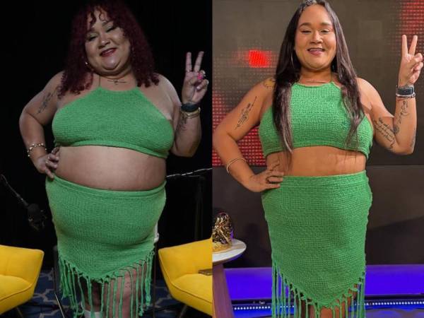 La influencer puertorriqueña, Xiomara La Negra murió el pasado 15 de noviembre luego de supuestas complicaciones tras una cirugía para ayudarle a seguir perdiendo peso.