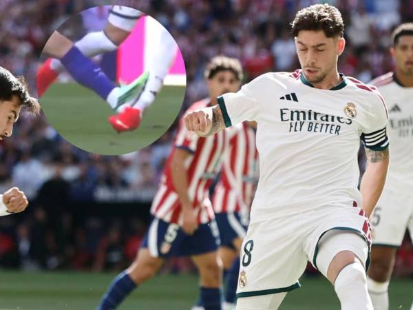 Fede Valverde terminó todo el partido pero según el Real Madrid sufre una lesión.