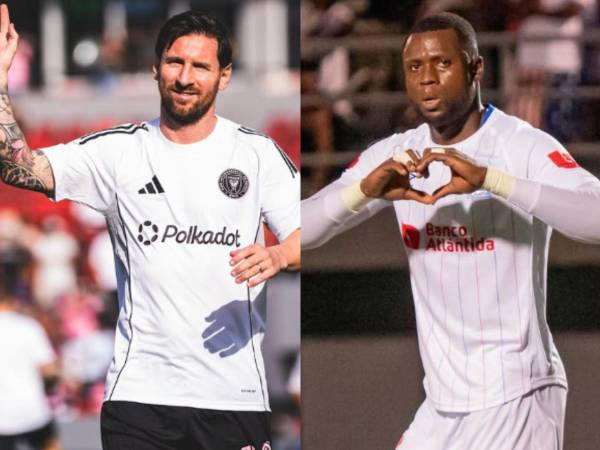 El partido del siglo con el “mejor jugador del mundo” Lionel Messi es hoy en el estadio Olímpico.