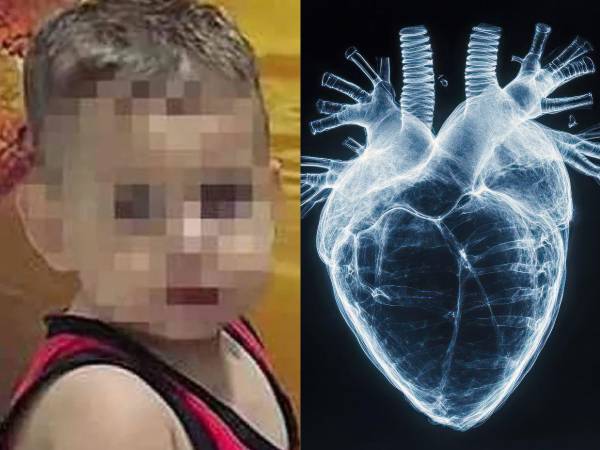 Los padres de Domenico, el niño italiano de dos años y medio que ha tenido a toda Italia pendiente tras recibir un corazón quemado en diciembre por presuntamente graves deficiencias en el transporte del órgano, han autorizado los tratamientos paliativos porque lamentablemente no hay esperanza.