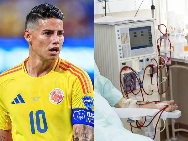 Minnesota United salió al paso y dio todos los detalles del padecimiento que sufre James Rodríguez, que incluso tuvo que ser hospitalizado.