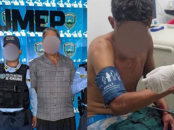 La víctima, cuya identidad no fue revelada, fue trasladada de emergencia al Hospital Mario Catarino Rivas, donde permanece bajo observación médica.