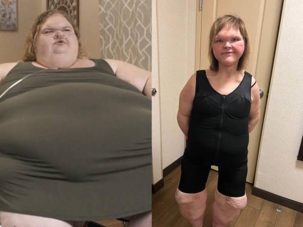 En 2020, Tammy Slaton se volvió una estrella de reality show tras que apareciera en el programa Kilos Mortales del canal TLC. Aquí te mostramos su cambió físico después de una varias cirugías y una alimentación balanceada.