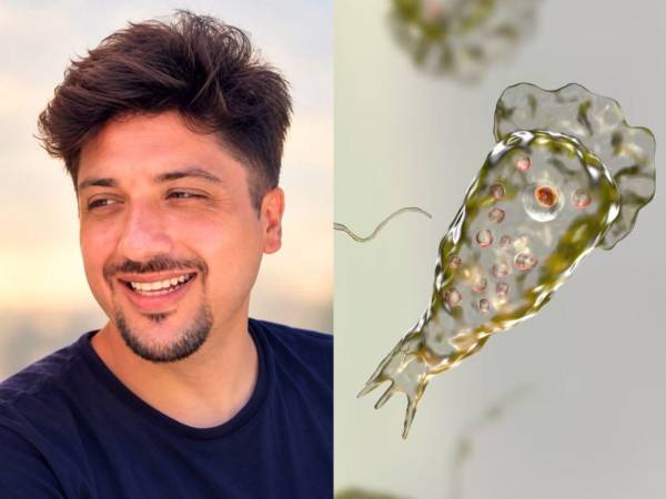 En los últimos días, un instructor de esquí acuático, únicamente identificado como Carlos, de 33 años, perdió la vida tras infectarse con la Naegleria fowleri, conocida como la ameba comecerebros, mientras laboraba en un lago artificial de la Plaza de la Isla, en Mérida, capital del Estado de Yucatán, en México. A continuación los detalles del caso.