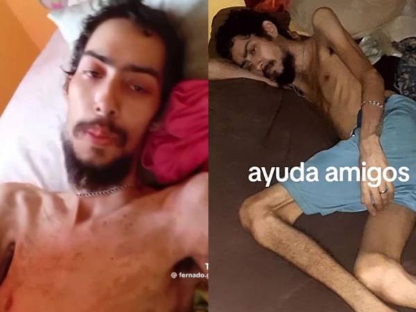 Fernando Galindo, el joven de La Ceiba, Honduras, que pedía en TikTok por un cupo en el hospital, falleció. Esto es lo que se sabe de la muerte del joven que se hizo famoso en la red social.
