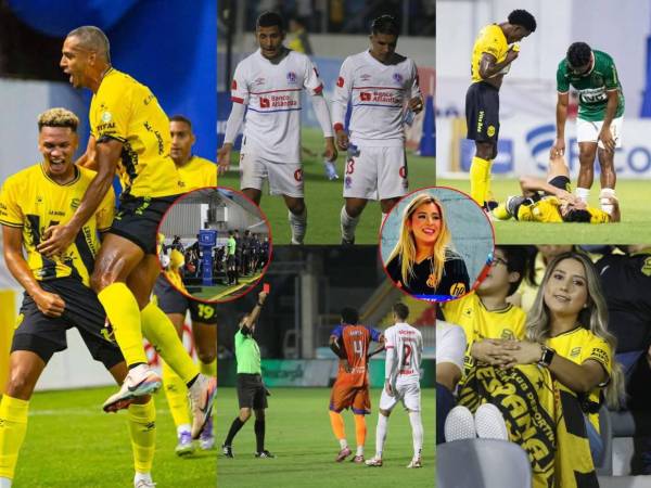 Este jueves se desarrollaron tres vibrantes partidos de la jornada 15 de la Liga Nacional de Honduras. Estas son las mejores postales que captó el lente de EL HERALDO.