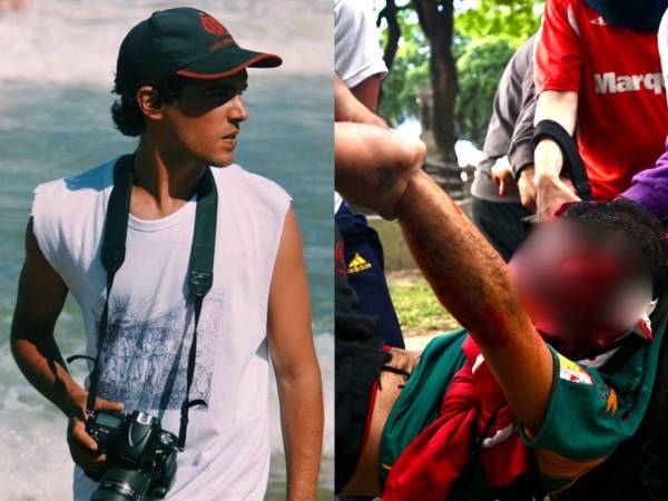 El fotógrafo recibió un impacto de gas lacrimógeno en la cabeza mientras se encontraba cubriendo una manifestación en Buenos Aires, Argentina.