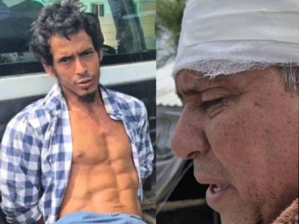 Un padre fue agredido por su hijo en La Ceiba, quien presuntamente le lanzó una taza de café y luego, lo golpeó.