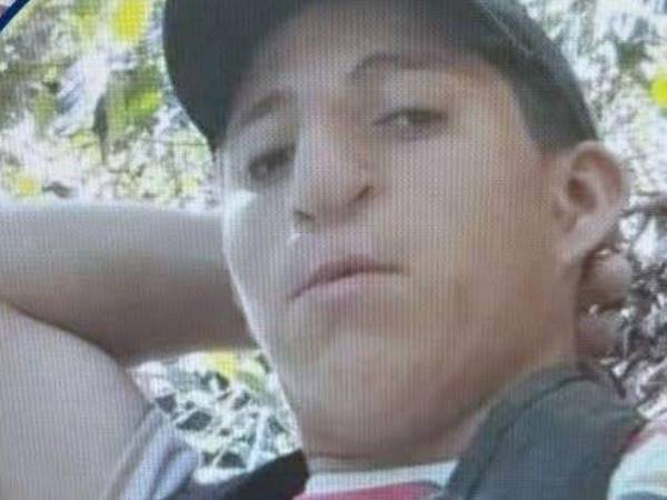 Debido a la gravedad de las quemaduras, fue trasladado de emergencia al principal centro asistencial del país, donde permaneció bajo atención médica durante 12 días, pero finalmente perdió la vida.