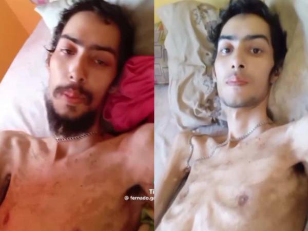Un joven hondureño de La Ceiba ha utilizado la red social TikTok para pedir ayuda por su salud y hasta clama por un cupo en el hospital. Quién es y que se sabe de este joven catracho.