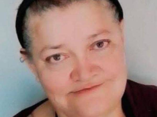 Bomberos utilizaron agua a presión para separar a los perros y rescatar a la víctima, quien falleció días después en el hospital.